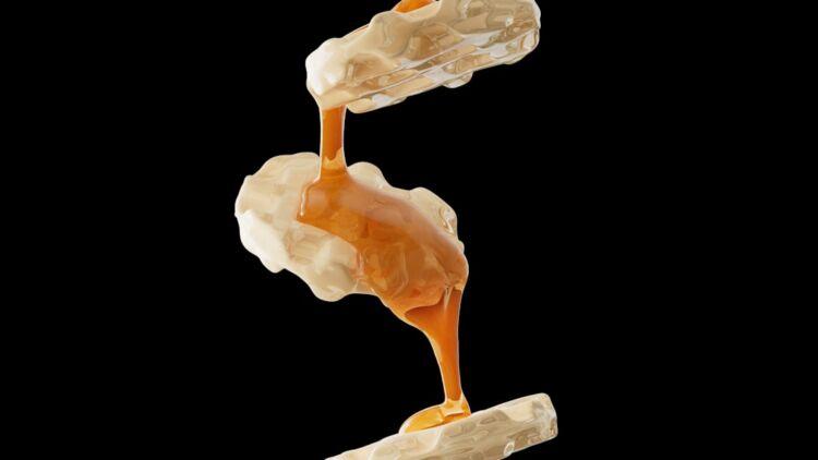 cellulite stages