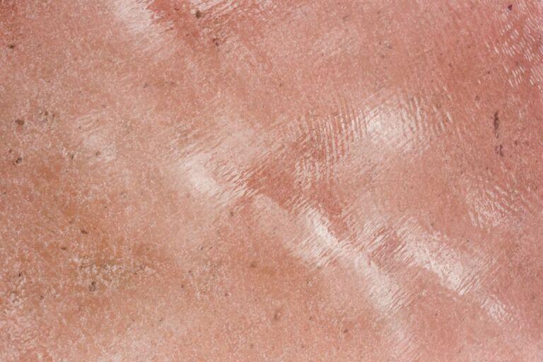 firm skin