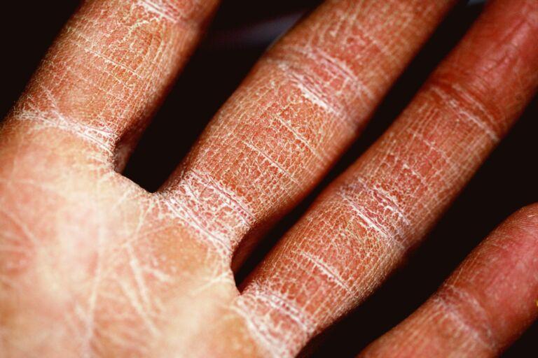 natural skincare